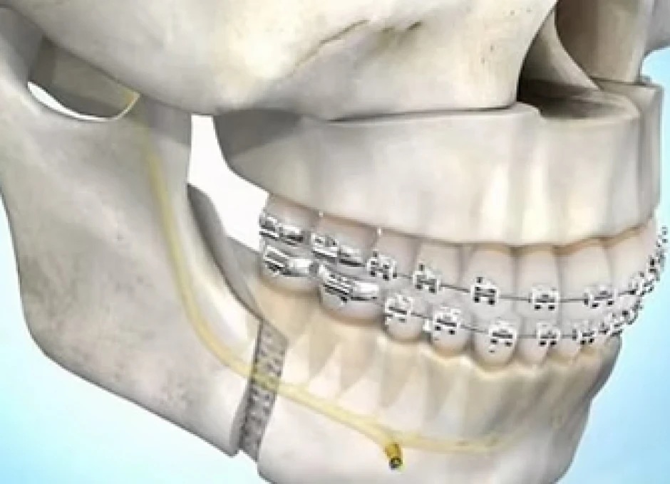 Module 10 - Orthodontie et CMF. Formation pour les orthodontistes, disponible à Lille (OLIO) et à Bruxelles (OBIO). Créé par Dr Emmanuël Bocquet