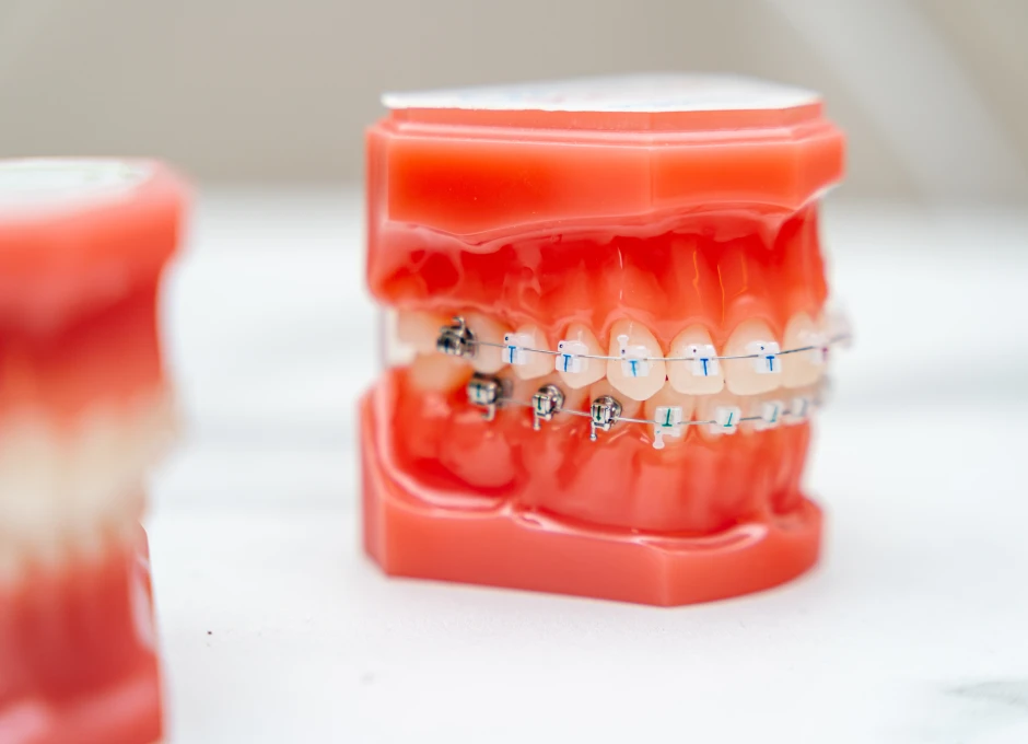 Module 3 - Traitement par multiattache. Formation pour les orthodontistes, disponible à Lille (OLIO) et à Bruxelles (OBIO). Créé par Dr Emmanuël Bocquet