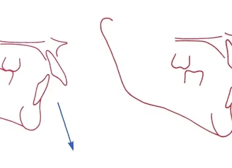Module 7 - Traitement des classes II et III. Formation pour les orthodontistes, disponible à Lille (OLIO) et à Bruxelles (OBIO). Créé par Dr Emmanuël Bocquet